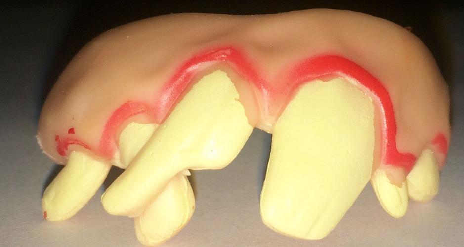 Кривые зубы - купить 