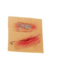 Накладная рана со свинцом